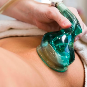 Vacuum Therapy for Body Contouring