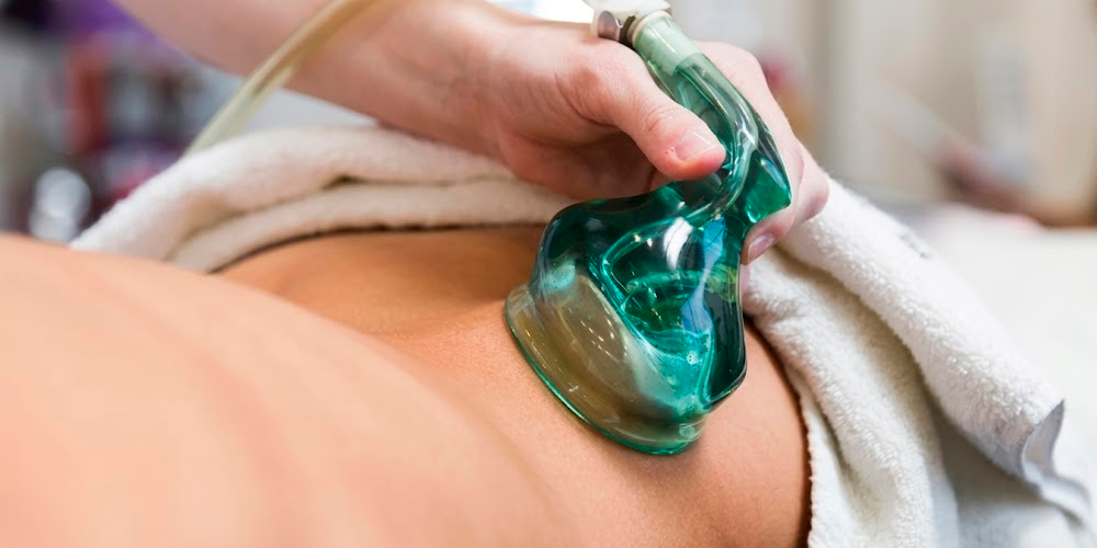 Vacuum Therapy for Body Contouring